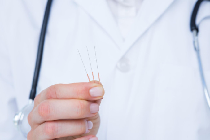 Doctor with acupuncture needles: SBDMedical Urological & Prostate Health Blog